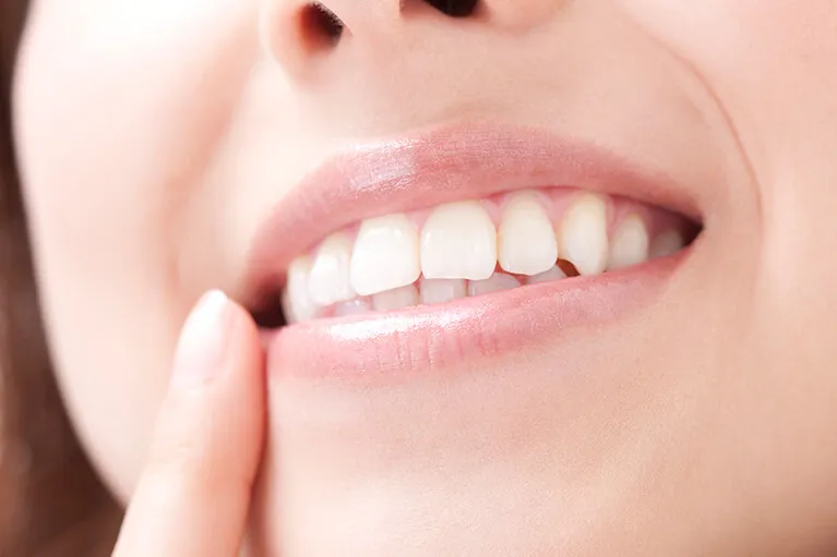 当院の審美治療について