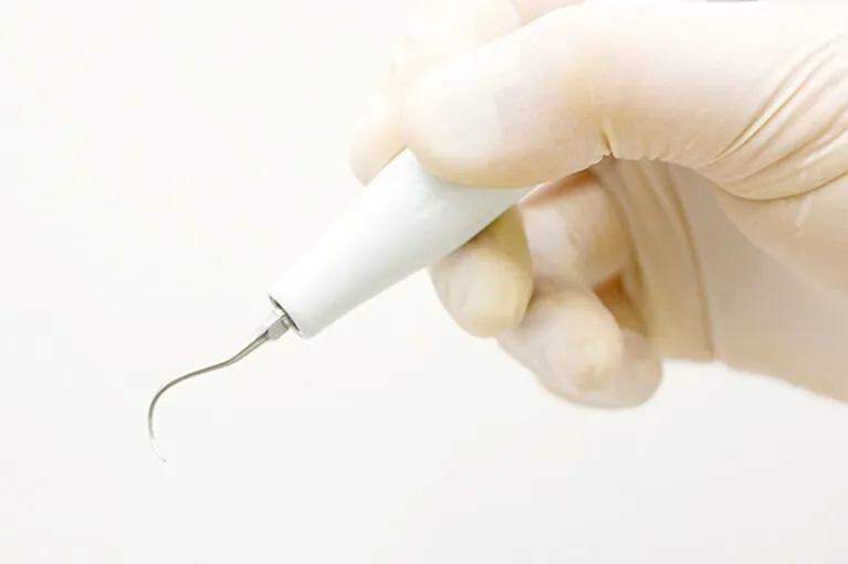 軽度の場合の歯周病治療